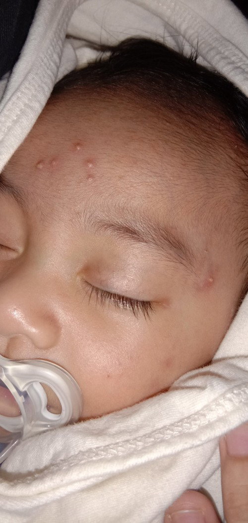 Ano kaya pwede igamot sa face ni lo ko? Nung 2m sya calmoseptine reseta ng pedia. 5mons sya ngayon