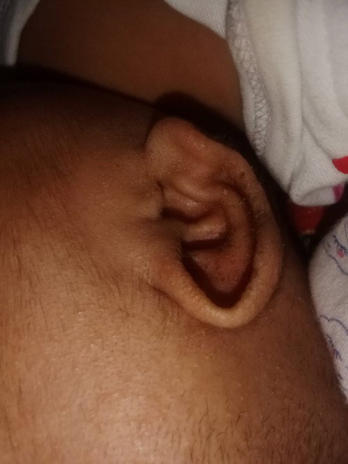 Telinga bayi berkeruping