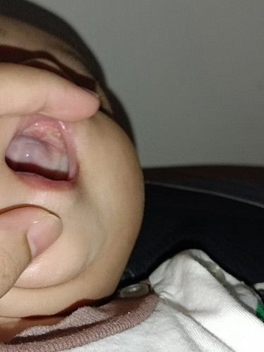 5 bulan dh tumbuh gigi ke