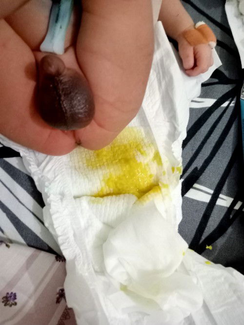 Pup bayi usia 5 hari