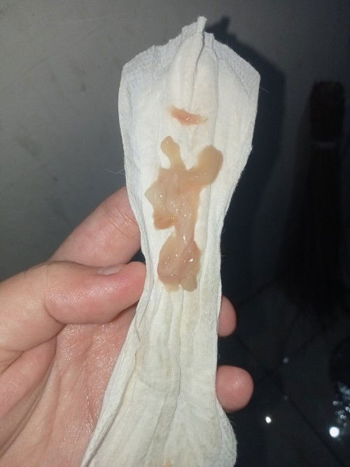 2-3cm na  pero di pa nag lalabor