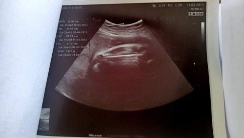 พอดีท้องเเรกค่ะ