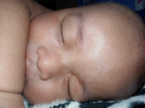 cara ilanginnya gimana ya bun? ini dede muka nya putih2 kaya panu dari umur 2bulan skrng 3 bulan