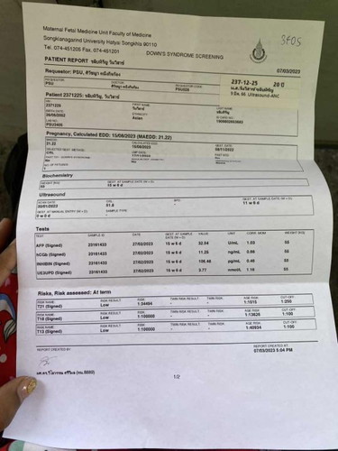 สอบถามหน่อยค่ะ แม่ๆบ้านไหนตรวจดาวซิโดมแล้วบ้างค่ะ