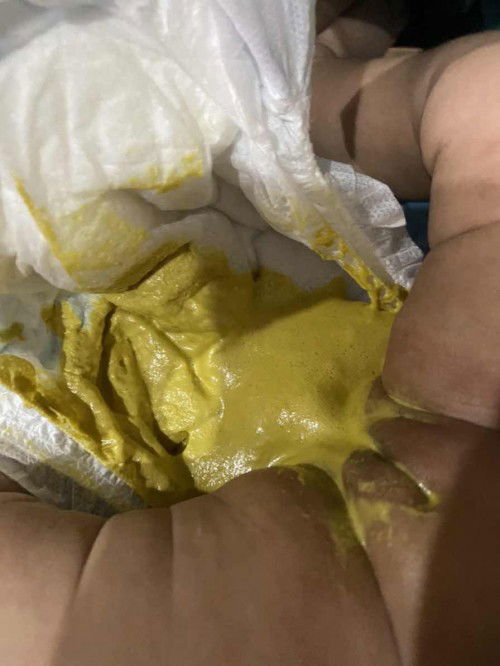 Baby i months 8 days