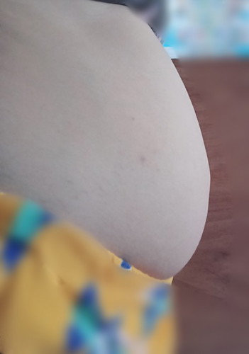 8 weeks pregnant