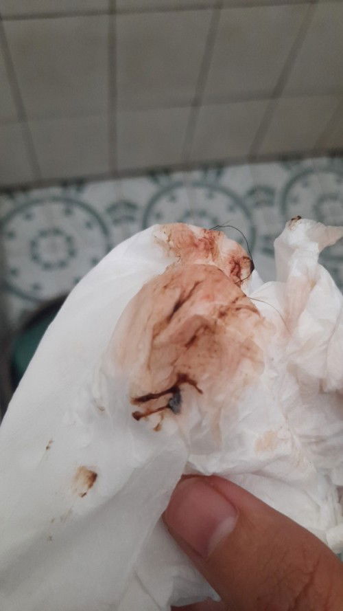 Janin tidak ada detak jantung