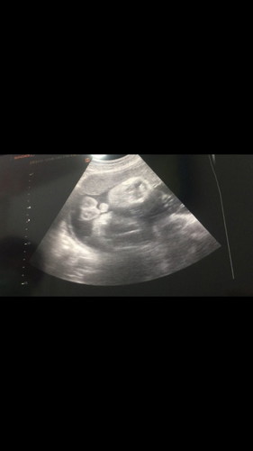 35+2 week ชายหรือหญิงค่ะ