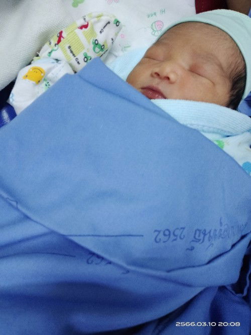 แตกแล้วค่ะ8/3/66โดนผ่าคลอดไปน้อง2,945ตอนนี้เจ็บแผลผ่าสุดๆเพราะนั่งรถกลับบ้านไกล100กว่าโลทางไม่ดีด้วย