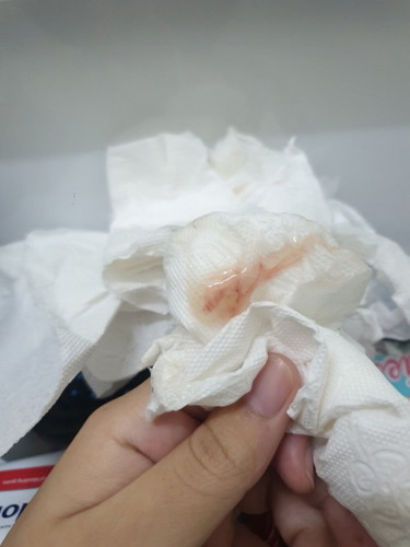 กระตุ้นปากมดลูก