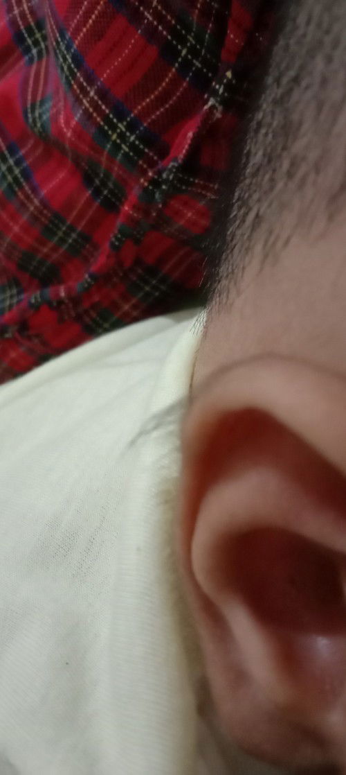Dipinggir telinga baby ada rambut halus yang panjang