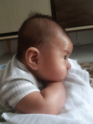 Elongated head shape ni baby