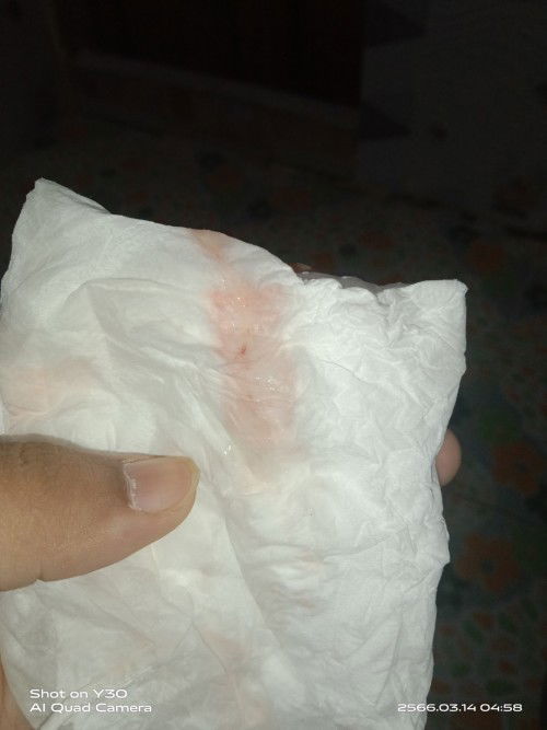 ถ้าเป็นเเบบนี้ควรไปหาหมอมั้ยค่ะ