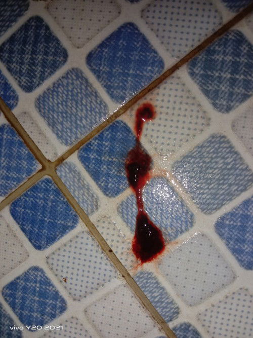 Assalamualaikum bun mau nanya