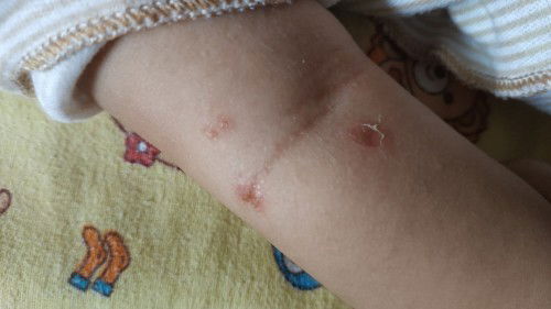 Bun ada yg tahu gak ya?