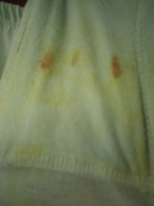 Flek coklat tanpa lendir