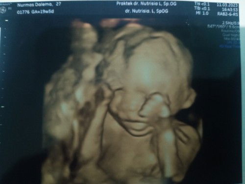 Bismillah, sehat selalu debay