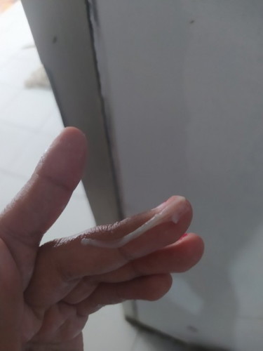 Keputihan 14 week normal apa berbahaya bun