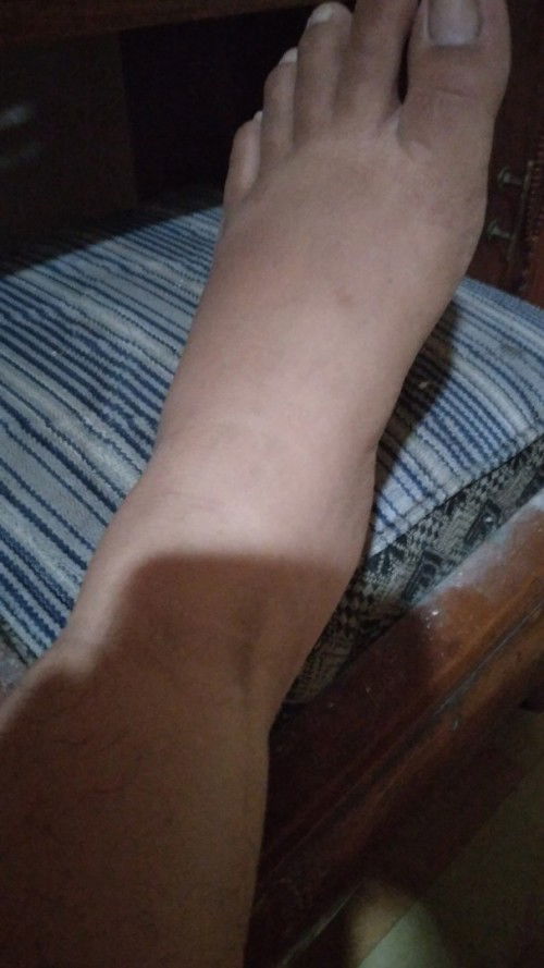 Kaki bengkak usia 36w