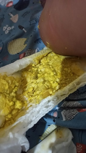 Tekstur Pup Bayi 5 Bulan