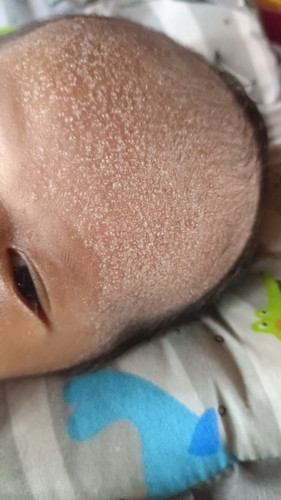 Ini kenapa ya kirakira bayi baru usia satu minggu tapi kog mrintis kaya berair