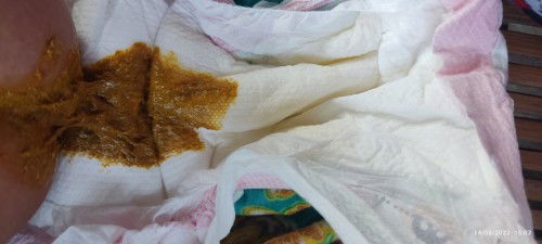 Poop of two months old baby