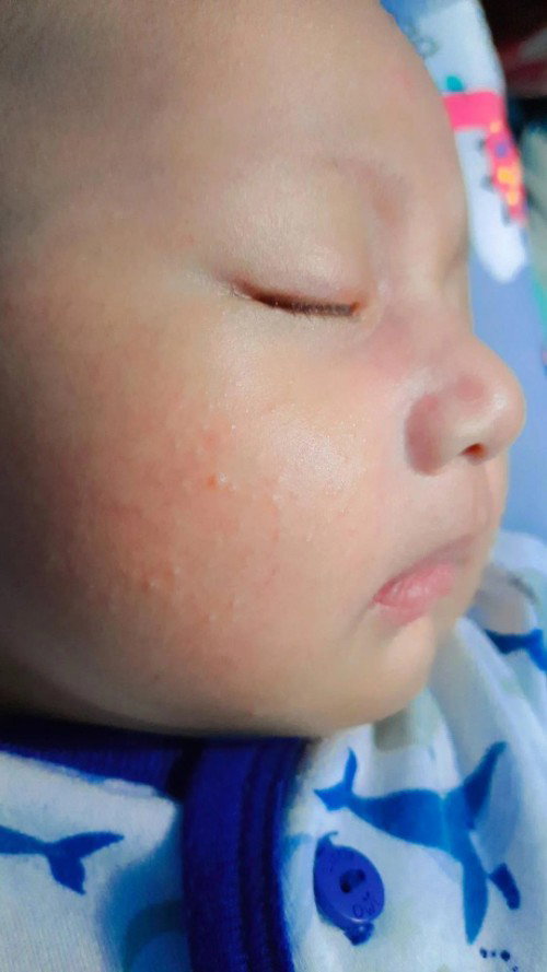 Beruntus pipi