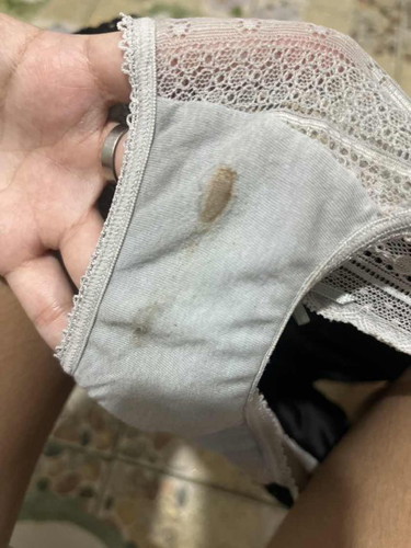 ขออภัยนะคะถ้ารูปไม่สุภาพ
