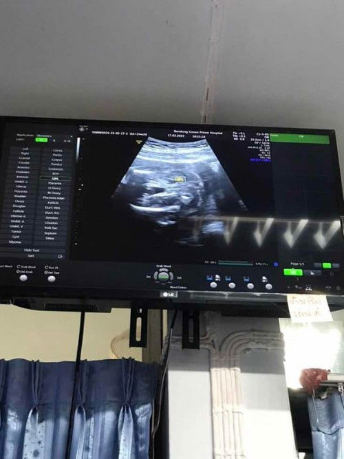 แม่ๆช่วยทายน้องหน่อยค่ะ  น้องเพศอะไร☺️☺️ 