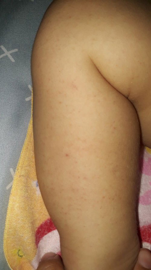 Bintik merah pada kaki