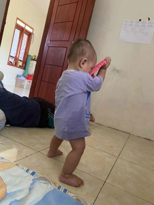 Bayi 10 bulan udah jalan, tapi gigix baru 2