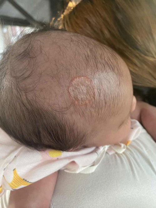 ลูกเป็นแบบนี้ที่หัวเป็นอะไรคะ