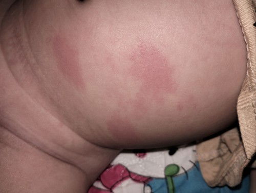 Bé bị gì thế m.n