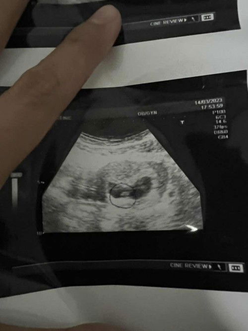 9w ไปซาวมาไม่เห็นตัวอ่อน