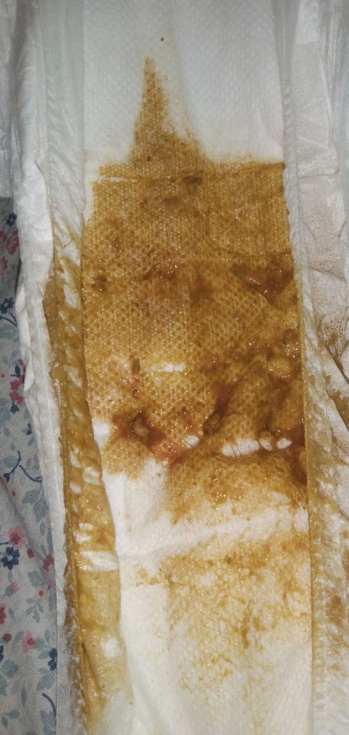 Nagtatae po baby ko . mag 3 days na . pinapainom ko sia pedialight . 1 year old po baby ko