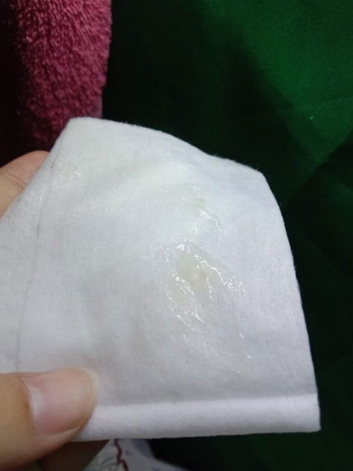 สอบถามแม่ๆค่ะอายุครรภ์38+1