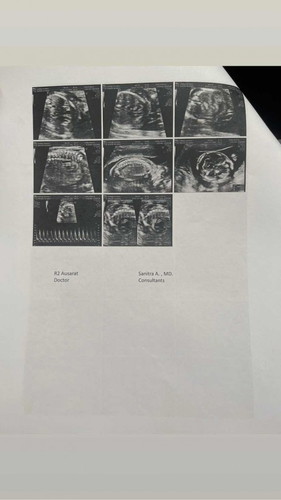 19 week ทีมสิงหาคม