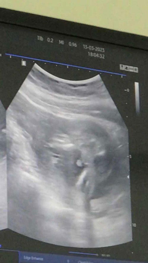 ดูเพศผู้หญิงหรือผู้ชาย