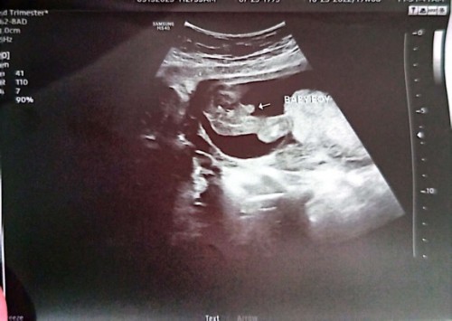 Baby boy po kaya talaga ? Hindi lang makapaniwla 😁😍❤️