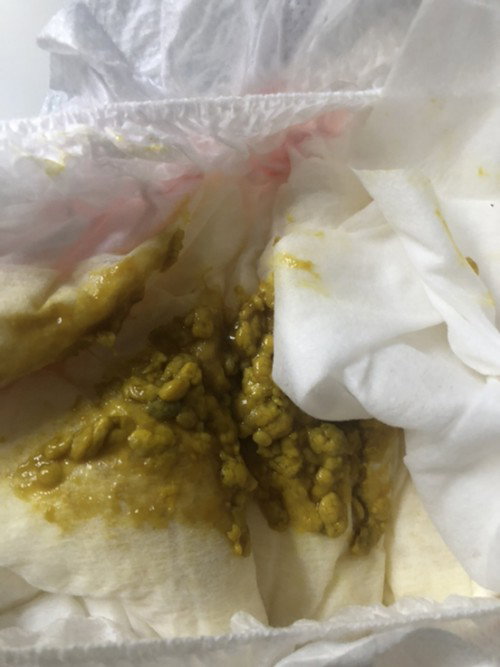 Hai ibu2, normal ke kalau anak umur sebulan fully susu formula dia berak mcm ni? Dan masa mnyusu