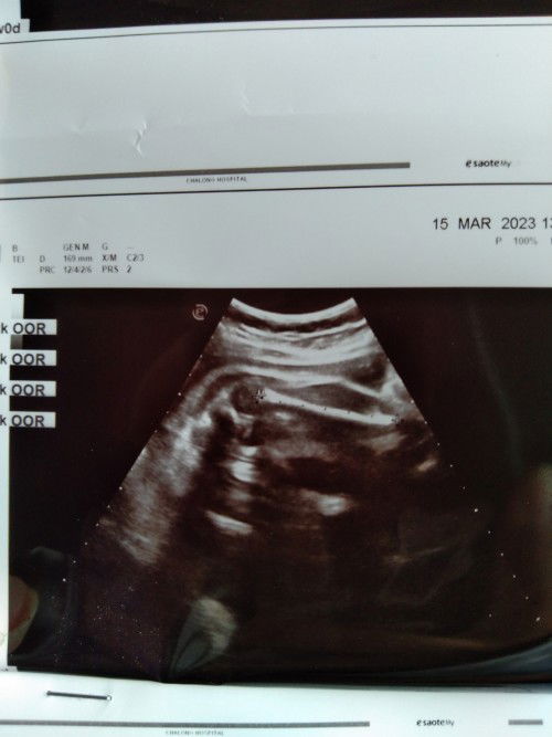 ช่วยดูให้หน่อยค่ะ