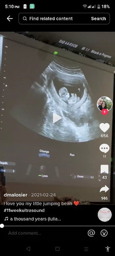11 weeks 6days ultrasound
