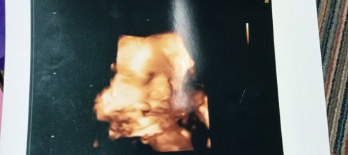 Hamil 36 week bayi belum masuk panggul,gimana caranya ya biar cepet masuk panggul?