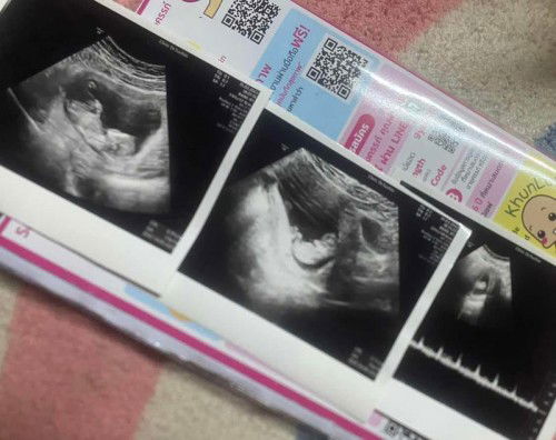 อัตราซาว ของแม่ๆเป็นไงบ้างคะ
