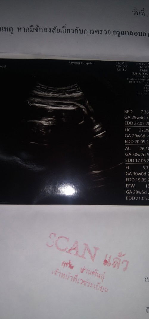 ขออนุญาตรบกวนสอบถามค่ะแม่ๆแบบนี้หญิงหรือชายคะอายุอายุครรภ์32+ 2 ค่ะ ขอบคุณสำหรับคำตอบล่วงหน้านะคะ