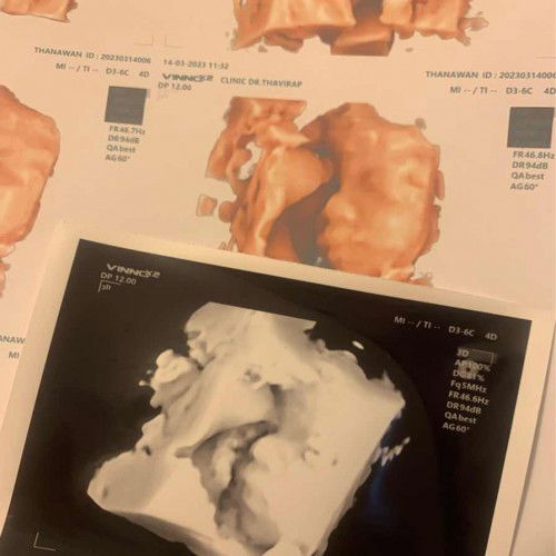 ซาว4มิติ28w4วัน