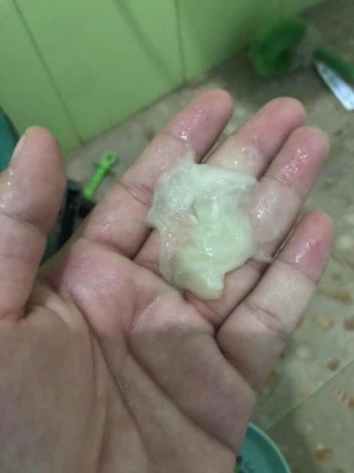 37+4 มีมูกแบบนี้ปกติไหม