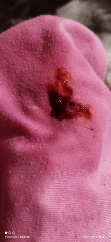 Bunda mau nanya kenapa ya bisa ada darah khawatir bgt soalnya hpl masih 23 maret,