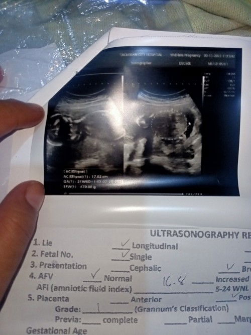 Baby boy na po ba talaga ? 5 months pregnant po