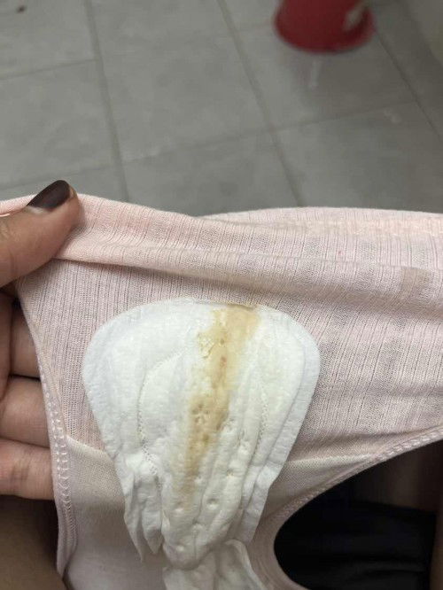 Normal ke ? Sy dri awal pregnancy skrg dah 7w4d still macamni? Risau 😭